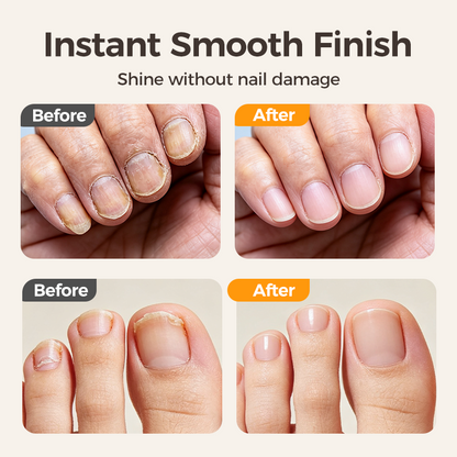 ✂️ LIMITED-TIME 49% OFF! 💅 2-in-1 Smart Electric Nail Clipper & Polisher 🌟